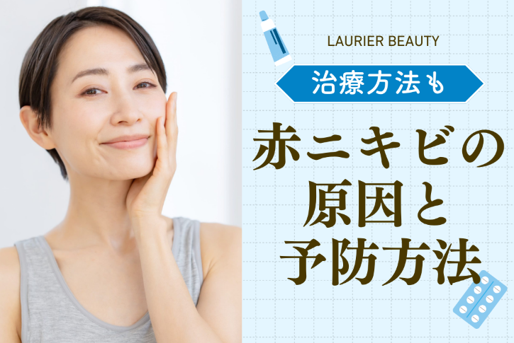 ニキビに関して、美容メディア「LAURIER BEAUTY」のコラム記事を５つ監修させていただきました。 画像