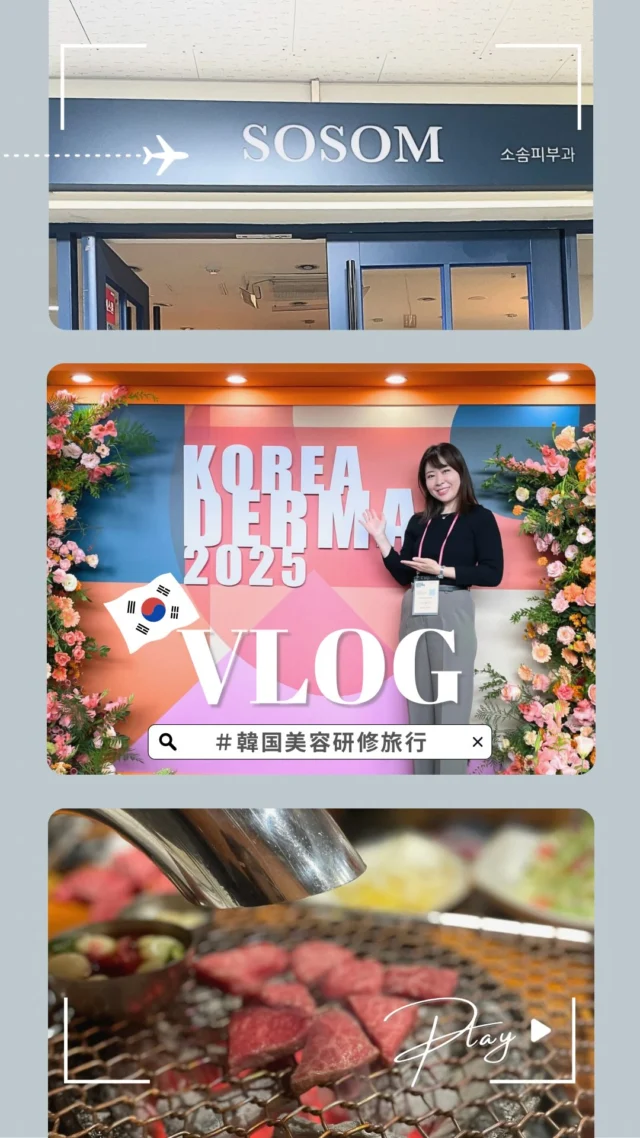 【韓国研修で広がった、診療への新しい視点】詳細は続きを読むから↓
@dr_shiori

美容医療の「いま」を学びに、韓国へ。

学会やクリニック訪問では、
先生方の確かな技術だけでなく、
『切らないアンチエイジング』に込められた
哲学や美意識にも触れ、
多くの共感と気づきをいただきました。

韓国の美容医療は、
スピード感と完成度の高さが目を惹きますが、
最も心に残ったのは、
一つひとつの手技がとても繊細で、
「美しさをデザインする」という姿勢が徹底されていること。

その上で、流行をそのまま真似るのではなく、
日本人の骨格や肌質、美意識に合わせて
どう自然に落とし込むか。
これは、私が診療の中でずっと大切にしている視点です。

研修の合間には、
現地に詳しい方に案内していただきながら、
街を歩き、食事を楽しみ、
久しぶりに日常から少し離れる時間も過ごせました。
外に出ることで思考が広がり、
日々の診療に向き合う気持ちが新しく整っていきます。

今回の学びや感覚を、
患者さまの「自然で心地よい美しさ」のために
還元していけるよう、
また日々の診療で丁寧に積み重ねていきます。

気づきがたくさんあって、
また現地で学びを深めたくなるような研修でした☺️✨
 = = = = = = = = = = = = = = = = = = = = = = = =
📌 施術は流行ではなく、骨格や表情の癖に合わせて“その方だけの自然さ”を設計しています。
💉 この投稿を保存してまた見返してくださいね。
📩 ご相談・ご予約は、プロフィールの公式LINEからお気軽にどうぞ。
= = = = = = = = = = = = = = = = = = = = = = = = =

💉ご予約は公式LINEより承っております
プロフィールのリンク🔗をTAP
→ 公式LINEからご予約いただけます

..........................................................
🏥STスキンクリニック青山
〒107-0061 東京都港区北青山２丁目９−１４
外苑前駅『3番 出口』より徒歩1分
🕐営業時間:10-18時（詳細はInstagramにて）
🌼休診日：不定期
.........................................................
#肌育キャンペーン
#美容医療初心者さん歓迎
#モジュール型美容治療
#STスキンクリニック青山
#しぃちゃん先生