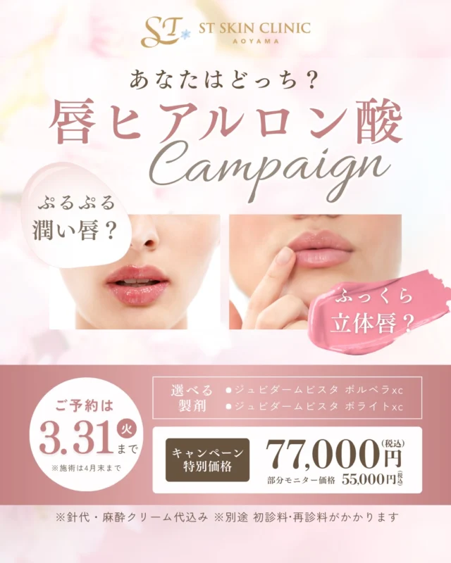 【うるツヤ唇？それとも輪郭くっきりリップ？】
リップヒアルロン酸のキャンペーンは続きを読むから↓
@dr_shiori

✔自然な潤いを出したい
✔ふっくら感や立体感がほしい
✔リップラインを整えたい

お好みや印象の変化に合わせて、
あなたに似合う自然で上品な唇デザインをご提案いたします。

唇ヒアルロン酸は
潤って可愛らしい印象に整えたい方、
エイジングケアとして取り入れたい方など、
幅広い年代の方にお選びいただける施術です。

唇ヒアルロン酸
77,000円（税込）

部分モニター
55,000円（税込）

※針代・麻酔クリーム代込
※別途初診料・再診料がかかります

ヒアルロン酸は注入治療のため、
大切なご予定の2週間前までに施術を済ませていただくことをおすすめしております。
余裕をもったスケジュールでご予約ください。

春のご予定に向けて、
自然で整った印象づくりをお手伝いいたします。

= = = = = = = = = = = = = = = = = = = = = = = =
うるツヤ唇や輪郭リップが気になる方へ
自然で上品な唇デザインのご相談・ご予約はプロフィールより承っております
公式LINEからお気軽にお問い合わせください☺️💕
= = = = = = = = = = = = = = = = = = = = = = = =

ご予約は公式LINEより承っております💉

プロフィールのリンク🔗をTAP

💬公式LINEからご予約
..........................................................
🏥STスキンクリニック青山
〒107-0061 東京都港区北青山2丁目9−14
外苑前駅3番出口より徒歩1分
🕐10:00–18:00（詳細はInstagramにて）
🌼休診日：不定期
..........................................................